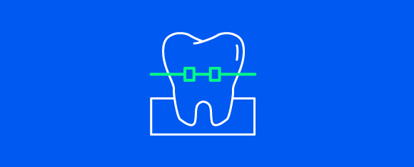 Dent cassée : l'assurance scolaire peut-elle intervenir dans ce type de sinistre ?